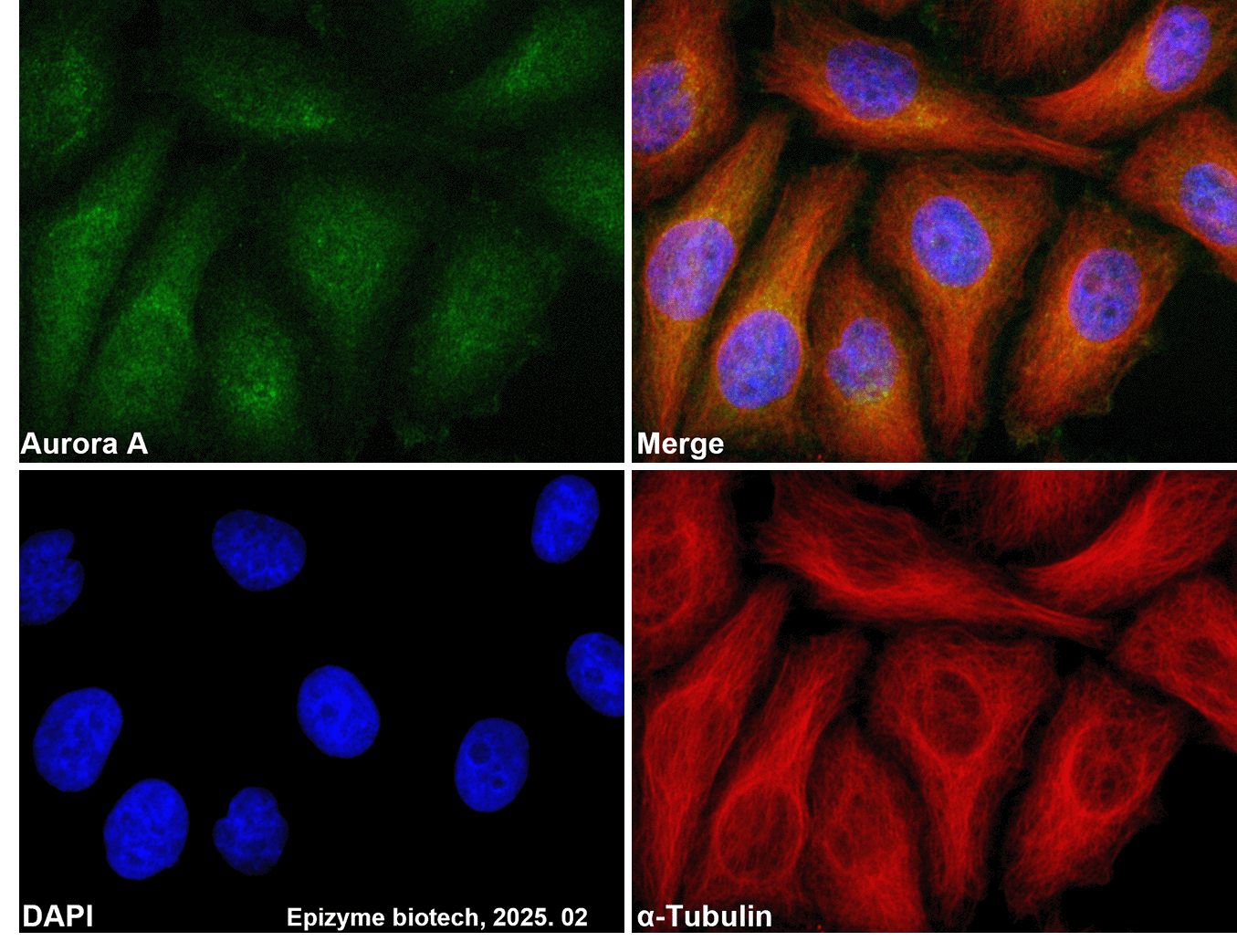 Anti-Aurora A Rabbit mAb [76A68G82]