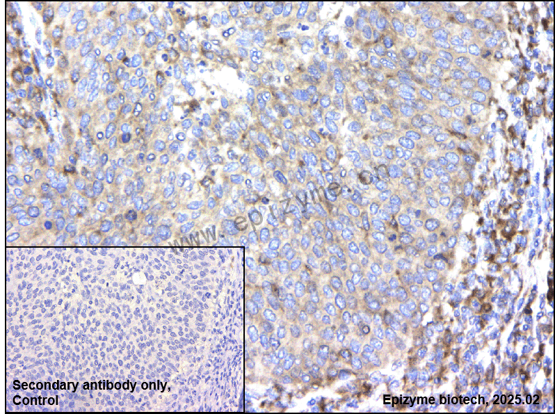 Anti-Aurora A Rabbit mAb [76A68G82]