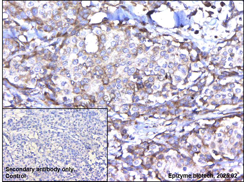 Anti-Aurora A Rabbit mAb [76A68G82]