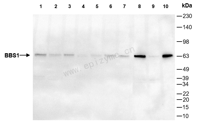 Anti-BBS1 Rabbit mAb [48L69P27]