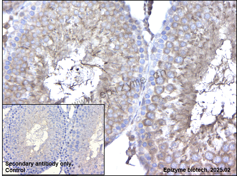 Anti-BBS1 Rabbit mAb [48L69P27]