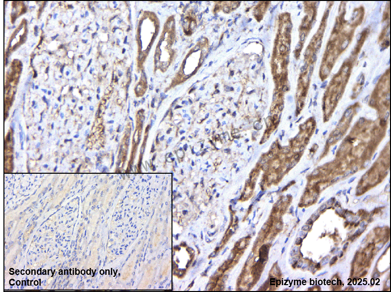Anti-BBS1 Rabbit mAb [48L69P27]