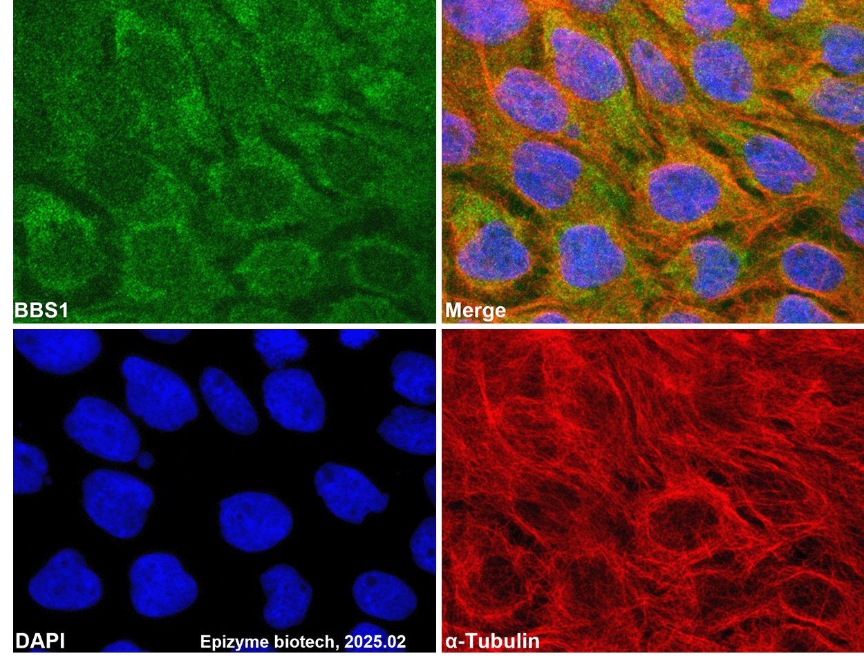 Anti-BBS1 Rabbit mAb [48L69P27]