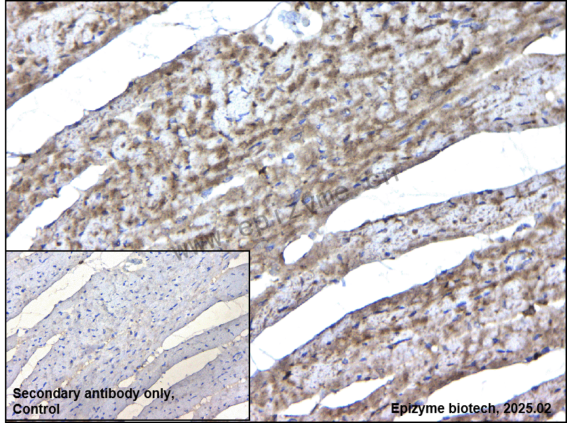 Anti-CAP2 Rabbit mAb [64T50N48]