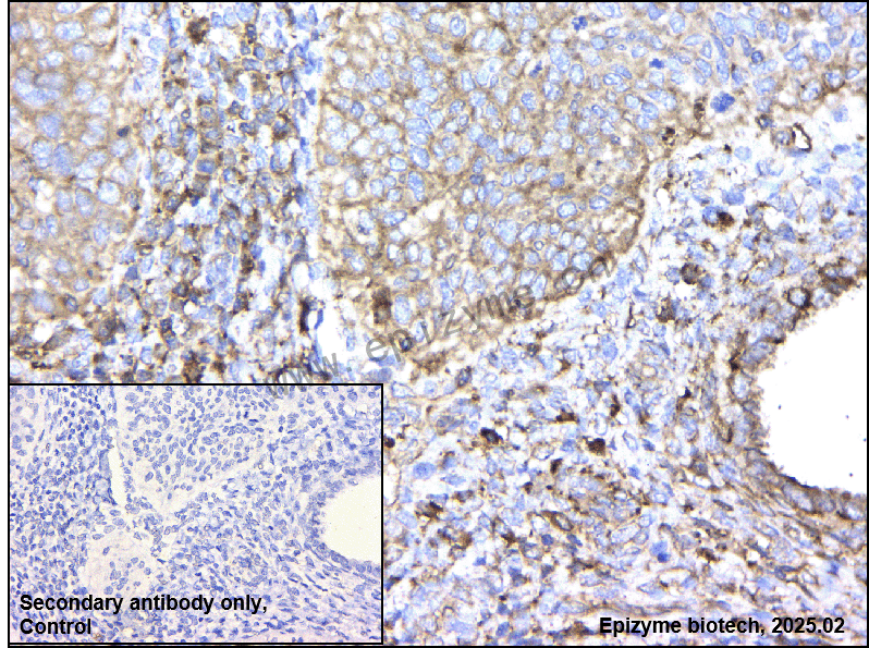 Anti-CAP2 Rabbit mAb [64T50N48]