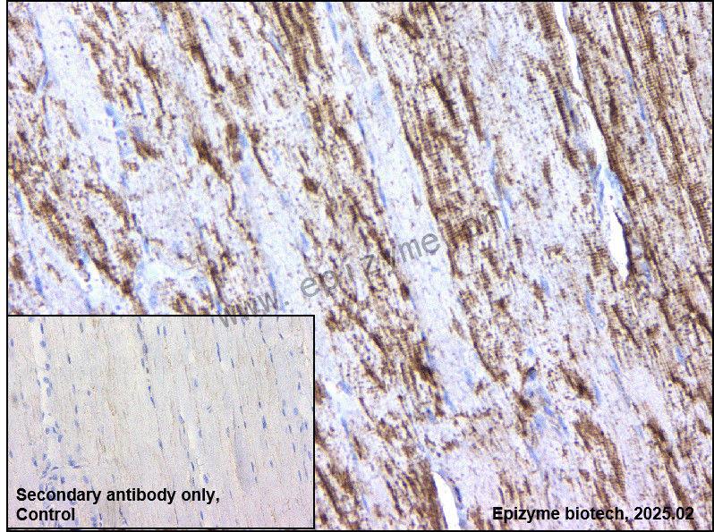 Anti-CAP2 Rabbit mAb [64T50N48]