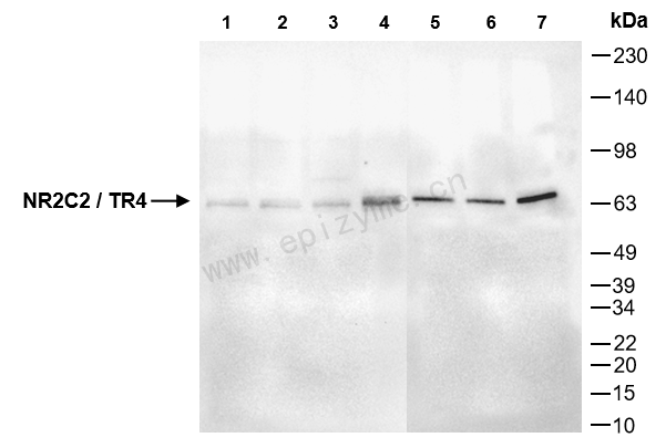 Anti-NR2C2/TR4 Rabbit mAb [57K33R38]