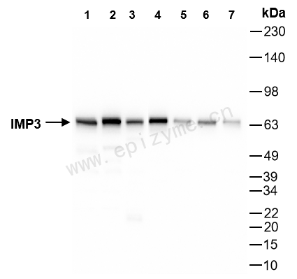 Anti-IMP3 Rabbit mAb [22Q03G39]