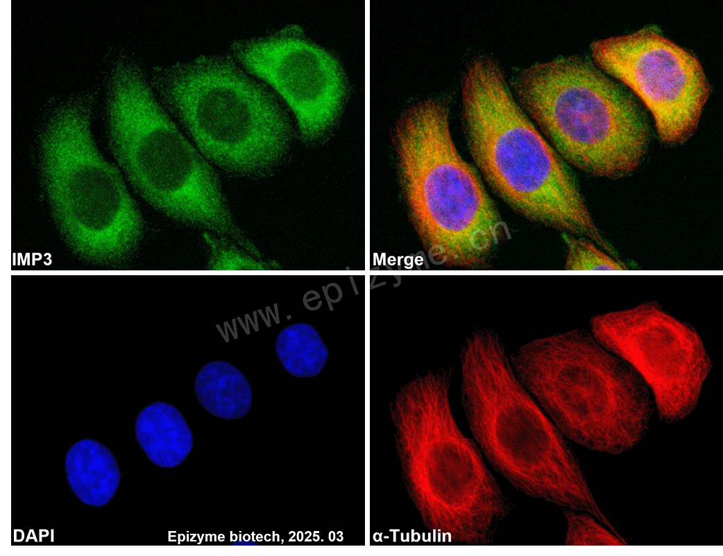 Anti-IMP3 Rabbit mAb [22Q03G39]