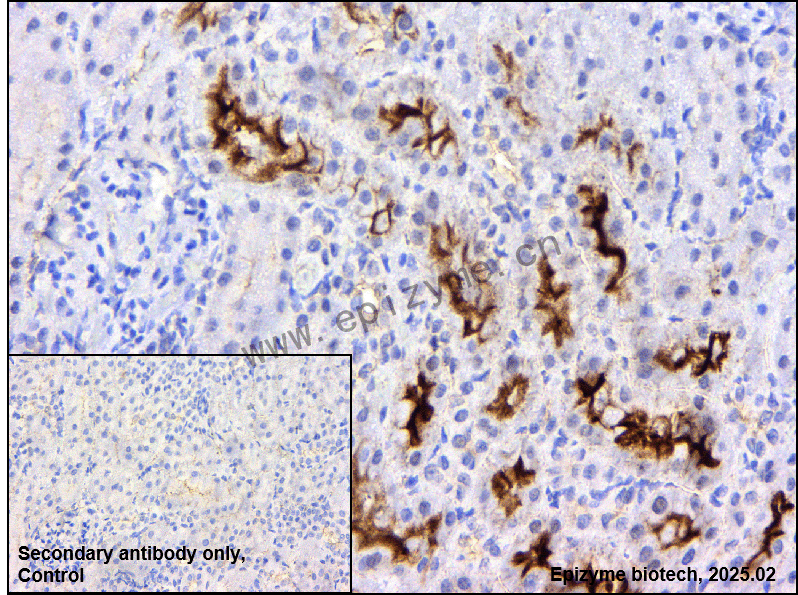 Anti-IMP3 Rabbit mAb [22Q03G39]