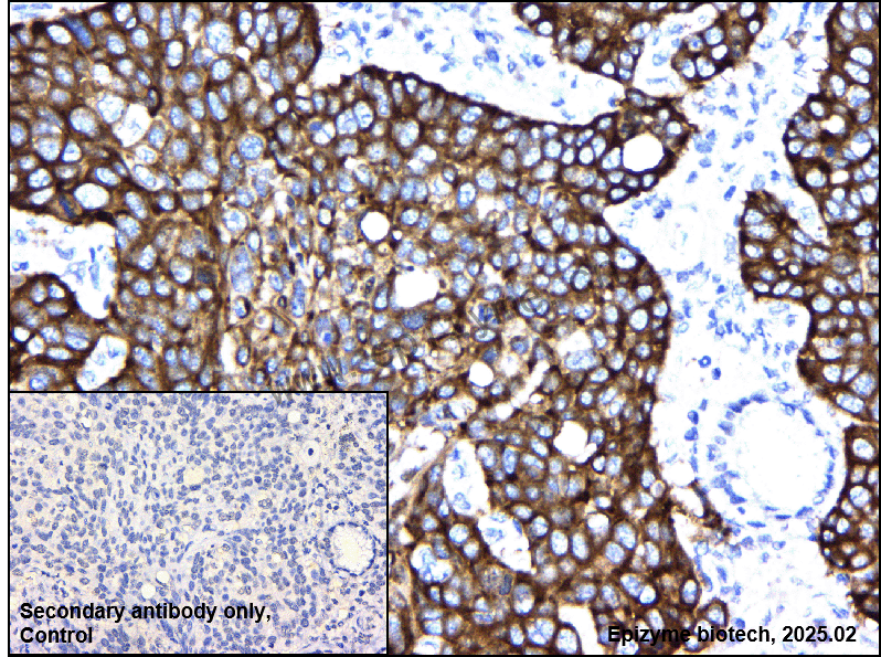 Anti-IMP3 Rabbit mAb [22Q03G39]