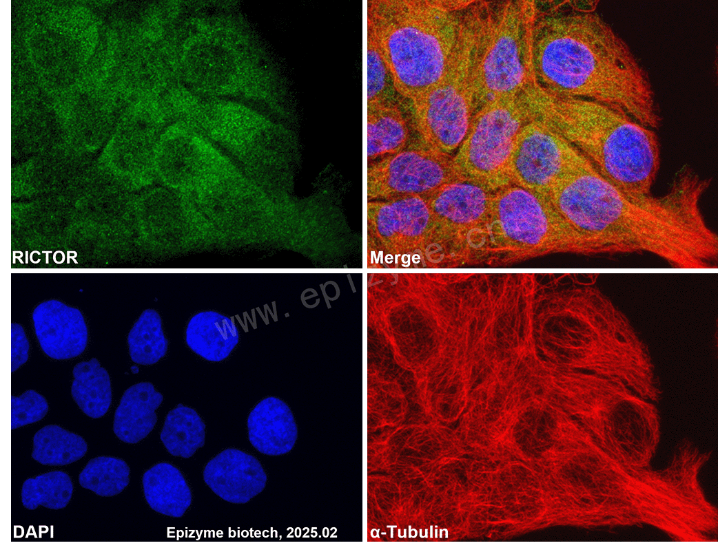 Anti-RICTOR Rabbit mAb [37I68J50]