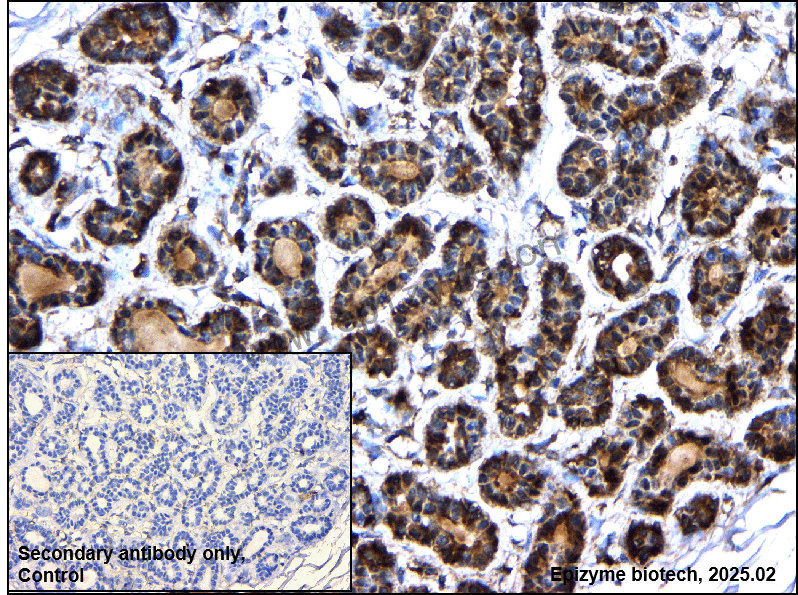Anti-RICTOR Rabbit mAb [37I68J50]