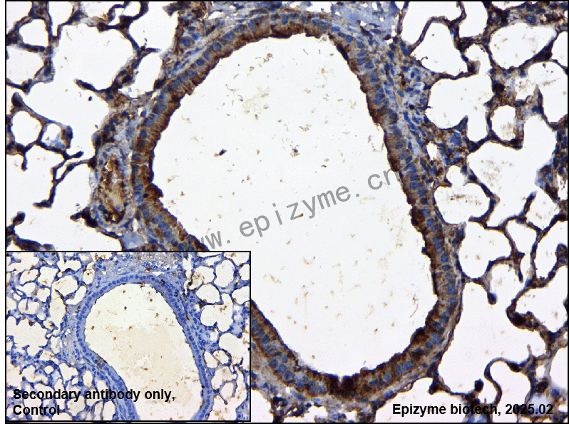 Anti-RICTOR Rabbit mAb [37I68J50]