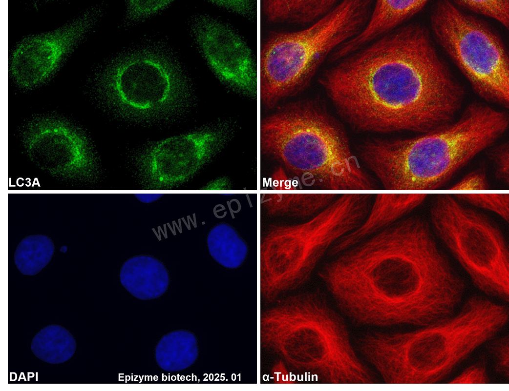 Anti-LC3A Rabbit mAb [13G54T49]