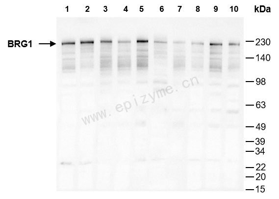 Anti-BRG1 Rabbit mAb [39F60F28]