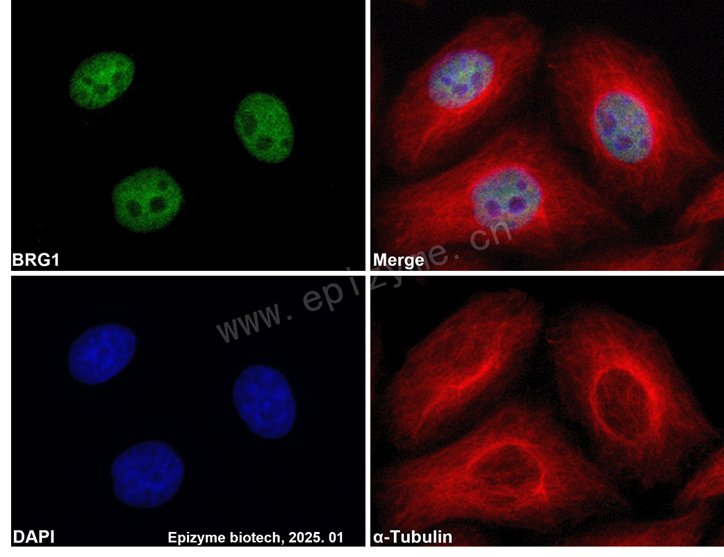 Anti-BRG1 Rabbit mAb [39F60F28]