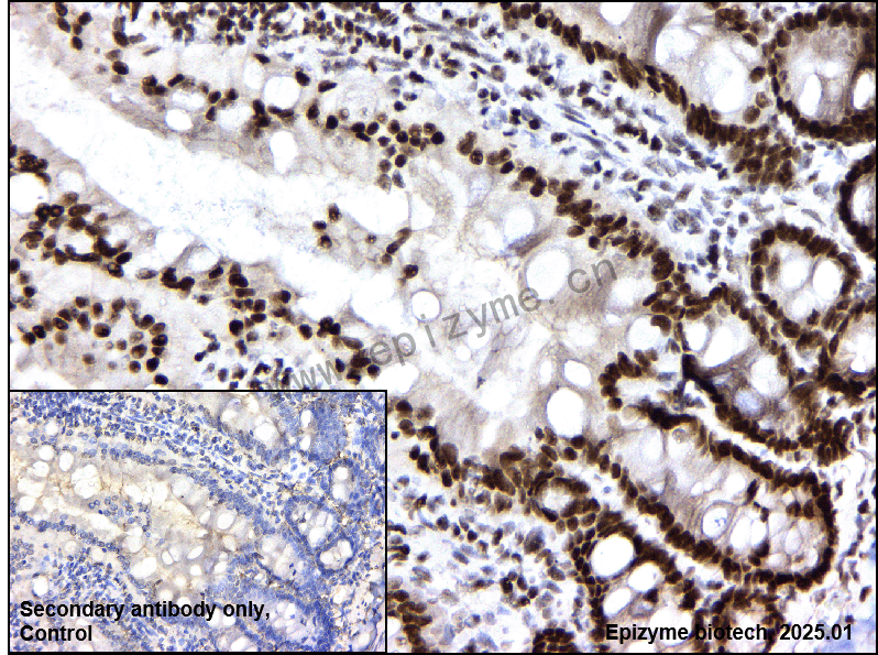 Anti-BRG1 Rabbit mAb [39F60F28]