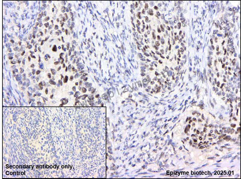 Anti-BRG1 Rabbit mAb [39F60F28]