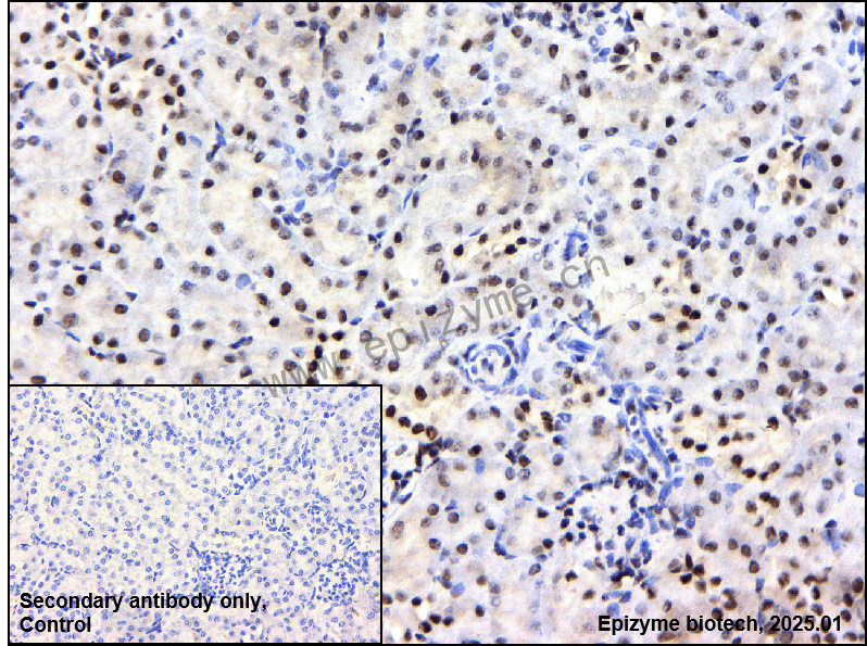 Anti-BRG1 Rabbit mAb [39F60F28]
