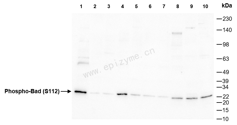 Anti-Phospho-Bad (Ser112) Rabbit mAb [22A67Q16]