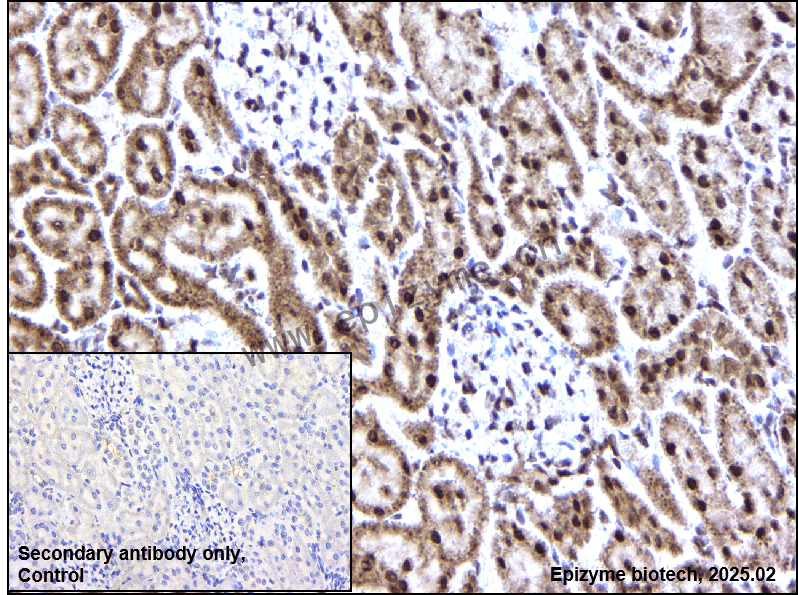 Anti-Phospho-Bad (Ser112) Rabbit mAb [22A67Q16]
