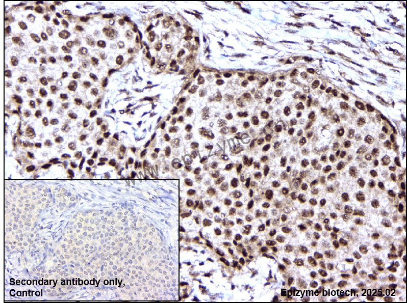 Anti-Phospho-Bad (Ser112) Rabbit mAb [22A67Q16]