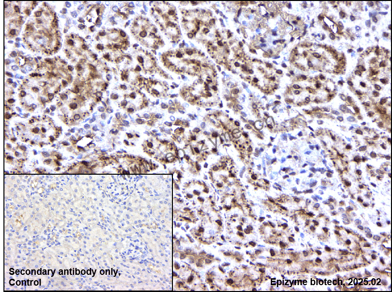 Anti-PI3 Kinase p110 beta Rabbit mAb [87H21R26]