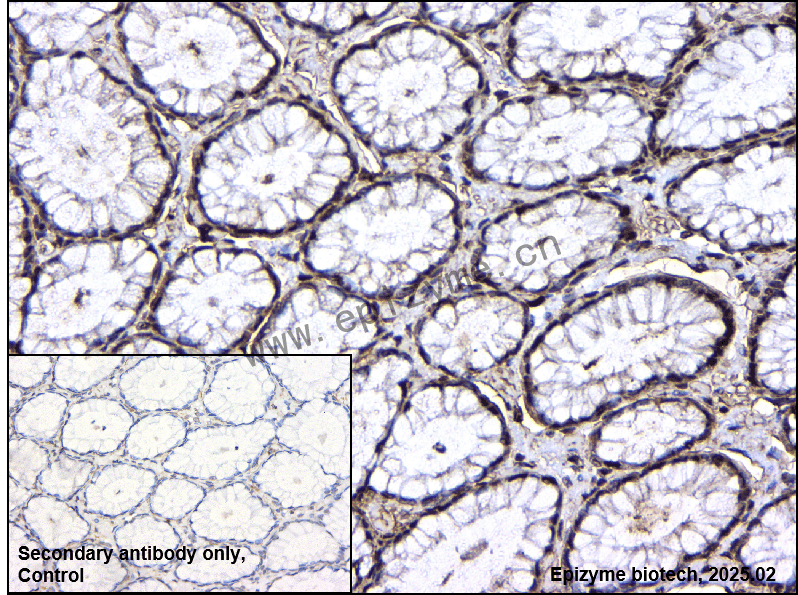 Anti-PI3 Kinase p110 beta Rabbit mAb [87H21R26]