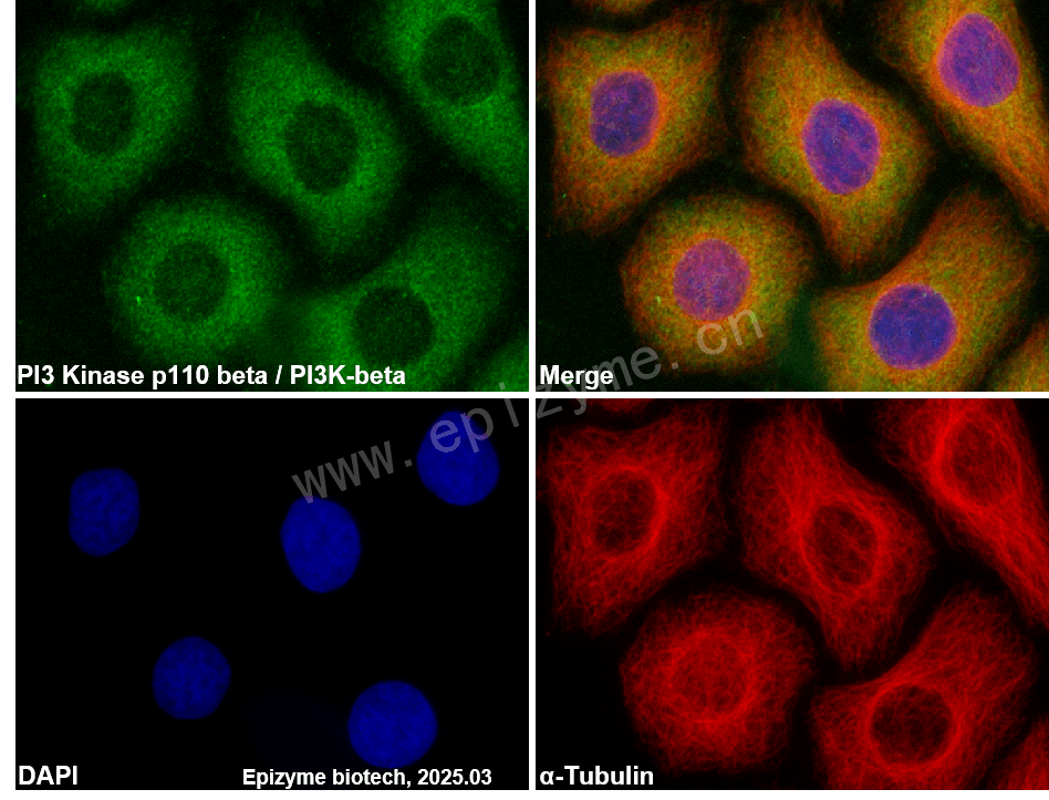 Anti-PI3 Kinase p110 beta Rabbit mAb [87H21R26]