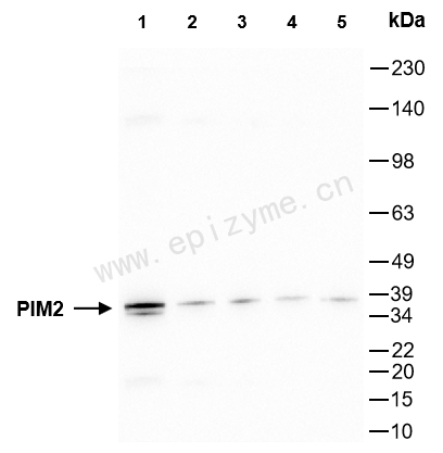 Anti-PIM2 Rabbit mAb [44T32Q91]