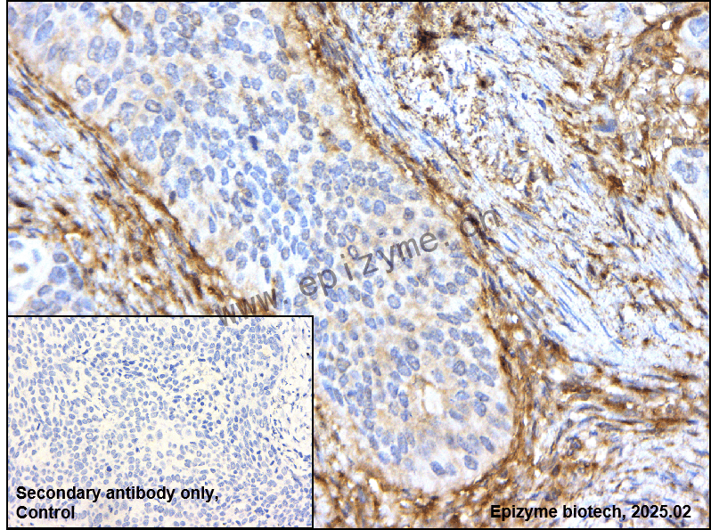 Anti-Caspase 8 Rabbit mAb [57A97C50]