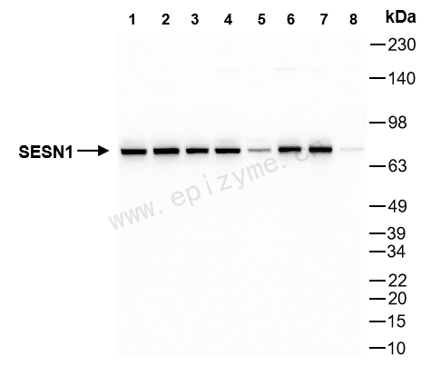 Anti-SESN1 Rabbit mAb [18T40M37]