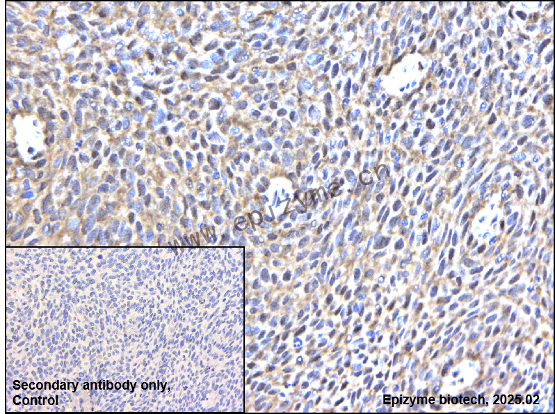 Anti-SESN1 Rabbit mAb [18T40M37]