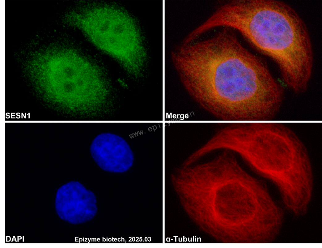 Anti-SESN1 Rabbit mAb [18T40M37]