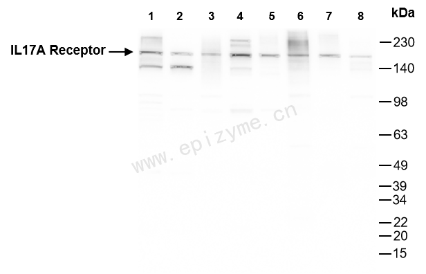 Anti-IL-17RA Rabbit mAb [80C84B07]