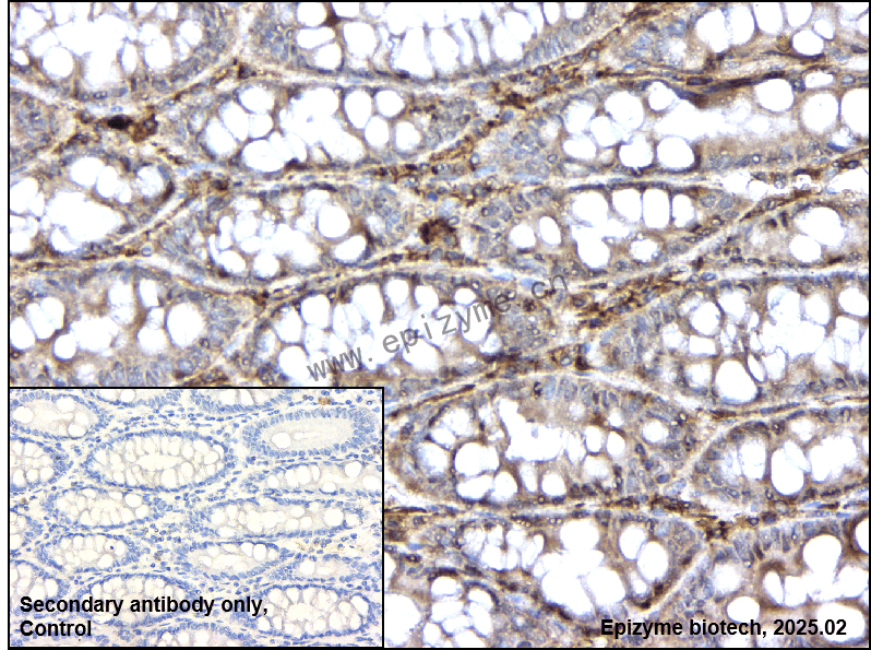 Anti-IL-17RA Rabbit mAb [80C84B07]