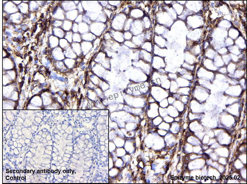 Anti-IL-17RA Rabbit mAb [80C84B07]