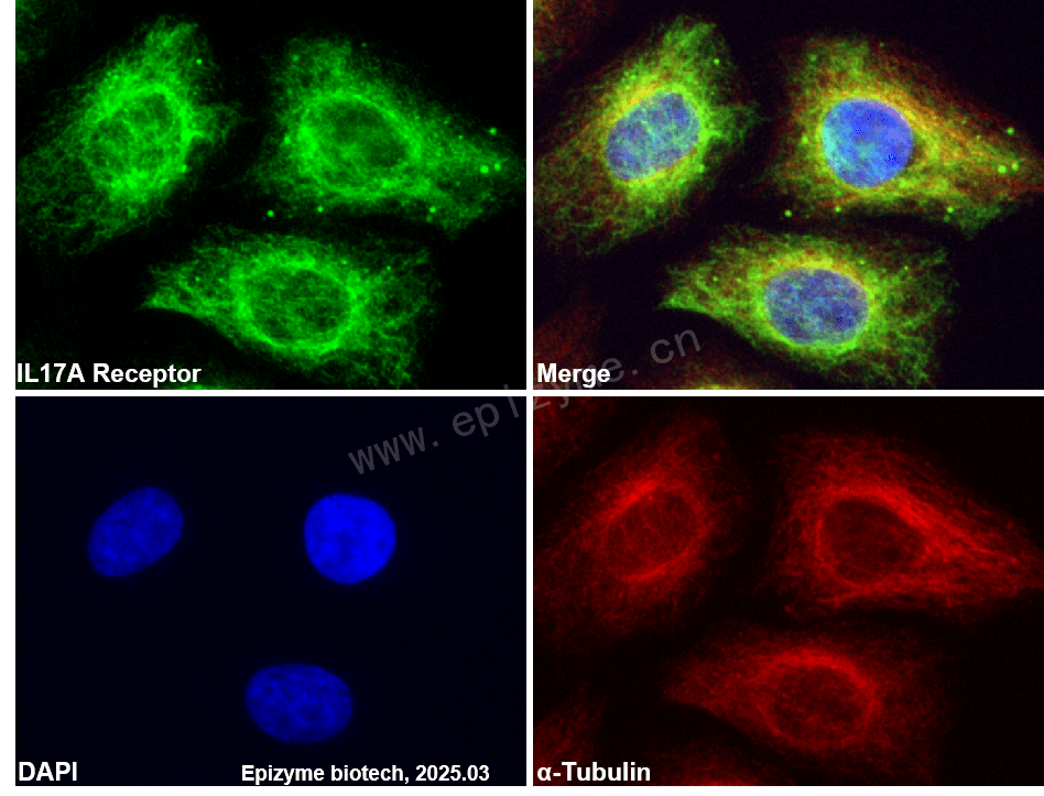 Anti-IL-17RA Rabbit mAb [80C84B07]