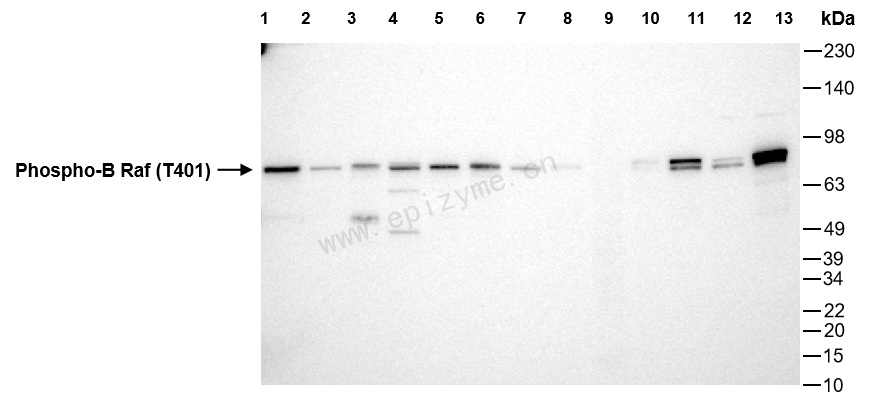 Anti-Phospho-BRAF (Thr401) Rabbit mAb [71S23B36]