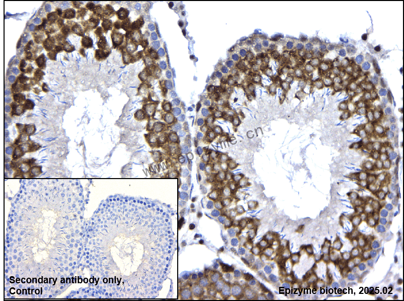 Anti-Phospho-BRAF (Thr401) Rabbit mAb [71S23B36]