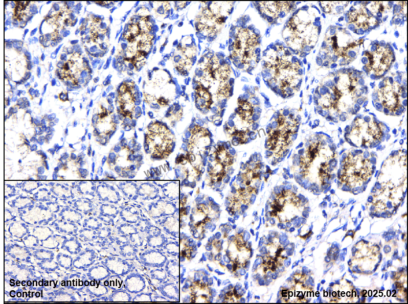 Anti-Phospho-BRAF (Thr401) Rabbit mAb [71S23B36]