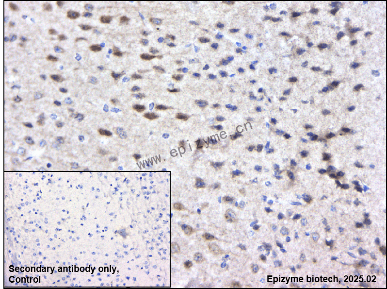 Anti-Phospho-BRAF (Thr401) Rabbit mAb [71S23B36]