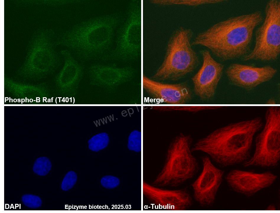 Anti-Phospho-BRAF (Thr401) Rabbit mAb [71S23B36]