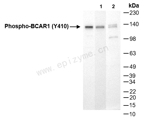 Anti-Phospho-BCAR1 (Tyr410) Rabbit mAb [67R00N60]