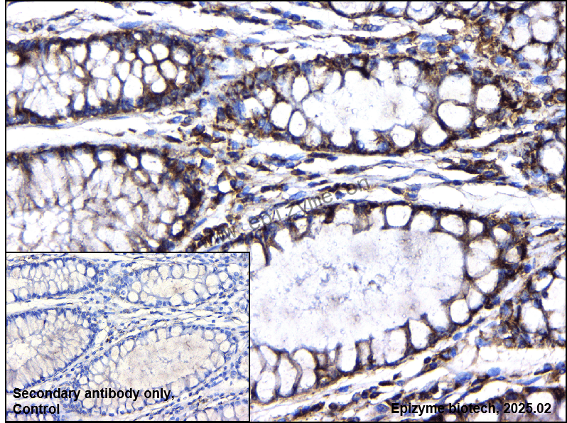 Anti-Phospho-BCAR1 (Tyr410) Rabbit mAb [67R00N60]