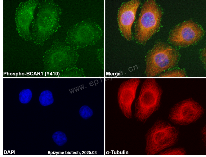 Anti-Phospho-BCAR1 (Tyr410) Rabbit mAb [67R00N60]