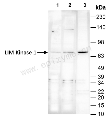 Anti-LIM Kinase 1 Rabbit mAb [42C37C10]