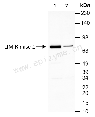 Anti-LIM Kinase 1 Rabbit mAb [42C37C10]