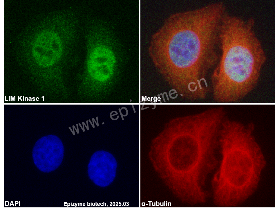 Anti-LIM Kinase 1 Rabbit mAb [42C37C10]
